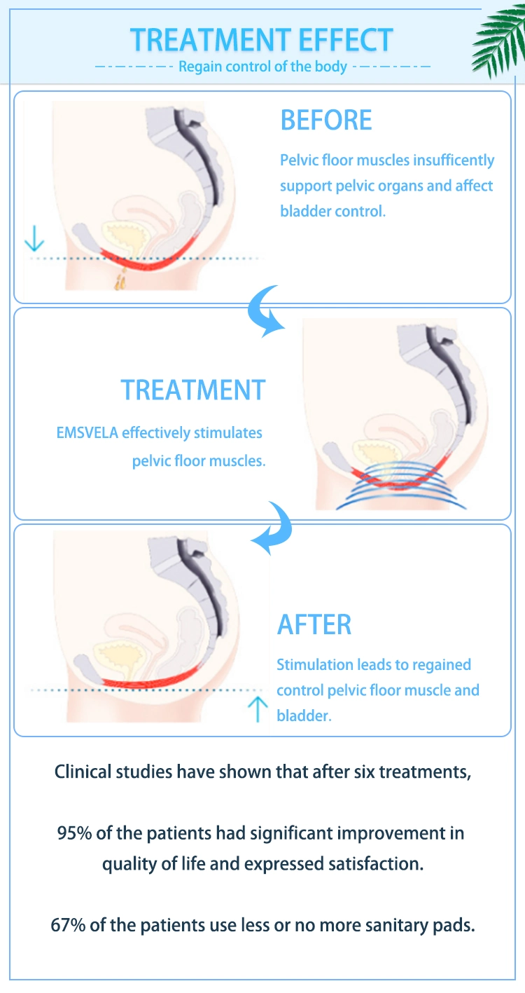 Muscle Stimulation Body Sculpt Slimming Em-Chair Hip Trainer EMS-Ellase for Incontinence Frequent Urination Treatment Vaginal Tightening and Pelvic Floor Repair