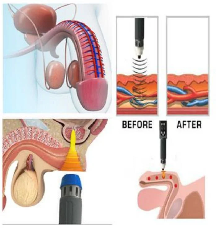 Portable Smart Tecar Wave EMS Therapy 448kHz Cet Ret Pain Relief Smart Tecar Wave 3 En 1