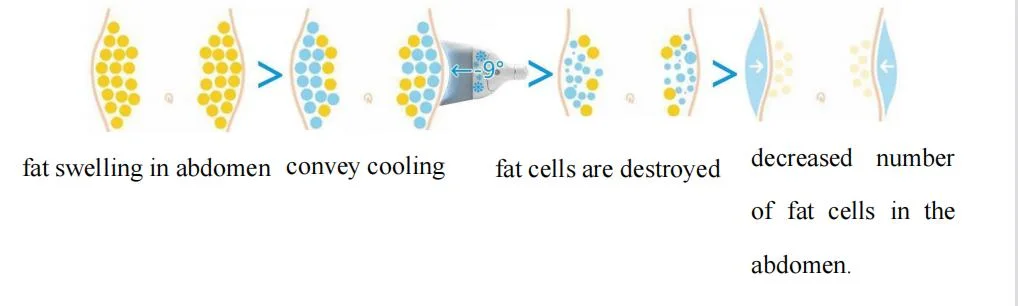 4D Cryolipolysis EMS Therapy Machine with Electromagnetic Stimulation for Body Slimming